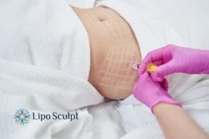 Are The Results From Aqualyx Permanent? 1 Do you want to know how long Aqualyx Folkestone results last?