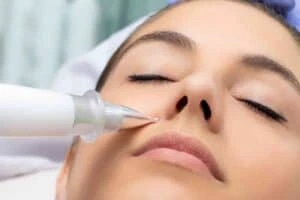 Best Actinic Keratoses Removal 3 Actinic keratoses Folkestone solutions - book in today!