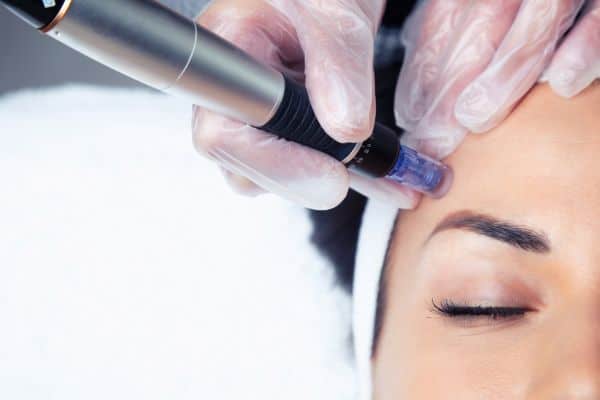 Explaining Total Skin Tightening Treatment and What to Expect 2 What Skin Concerns Can Total Skin Tightening Treatment Help With Folkestone?